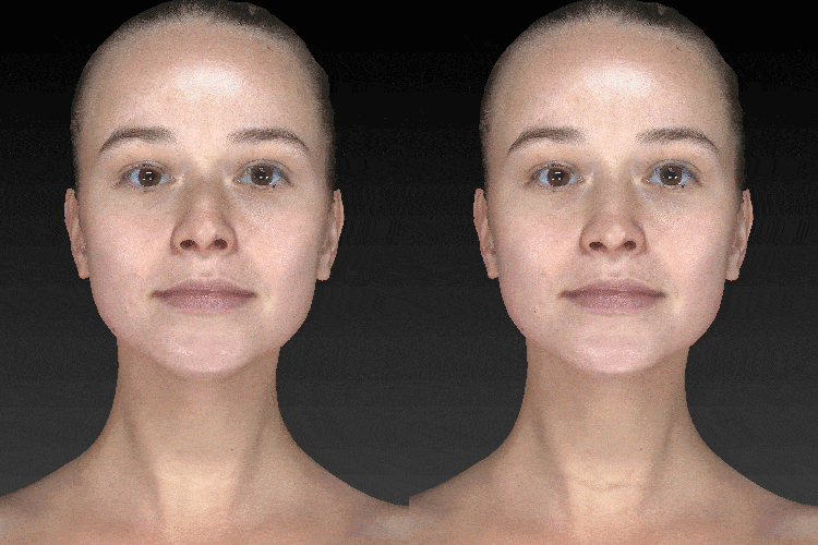 術後の正確性を向上させる3D画像シミュレーション診断